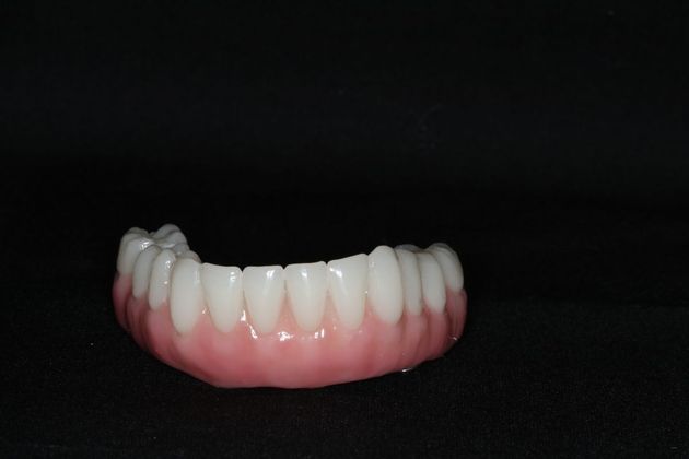 Teeth In A Day: Case 24 - Before