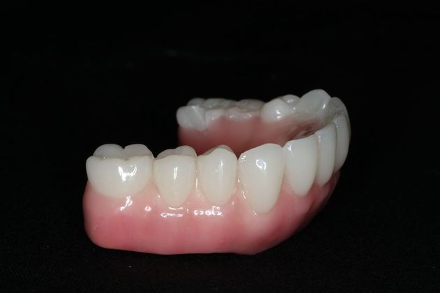 Teeth In A Day: Case 24 - After