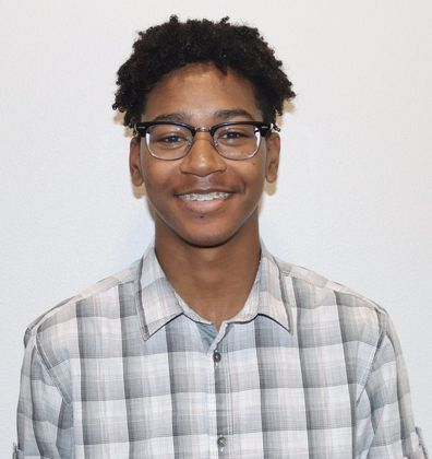 Orthodontics: Traditional Braces - Before