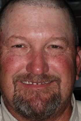 Veneers Case 26 - Before