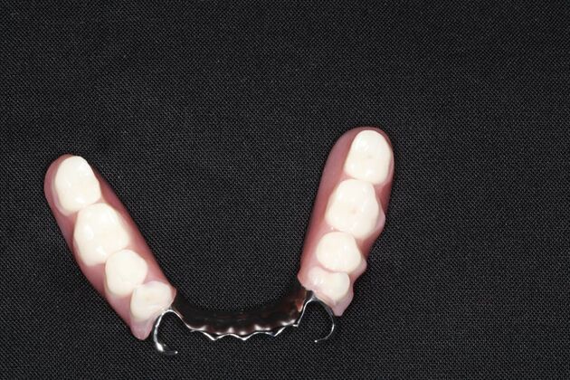 Dentures: Case 15 - Before