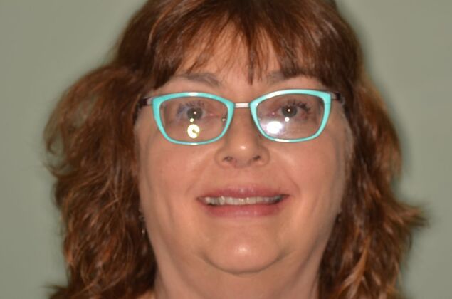 Invisalign: Case 22 - After