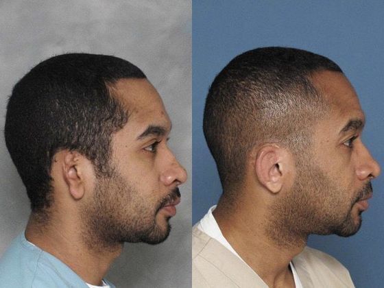 Injuries: Patient 1 - 31 yr. old man seen after car accident & 10yrs. after a single surgery.