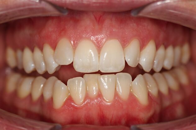 Orthodontics Beth - Before