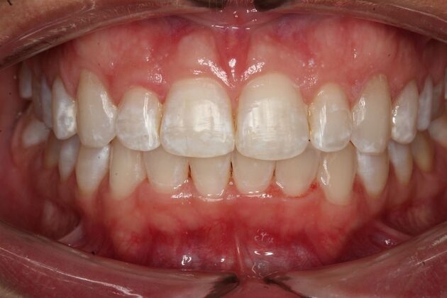 Orthodontics Jennifer - After