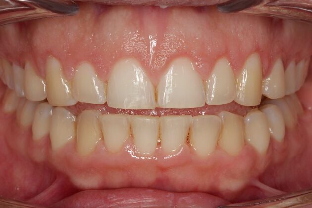 Orthodontics KC - After