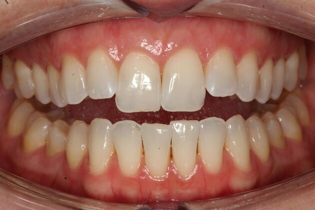 Orthodontics Jamie - Before