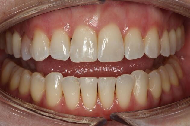 Orthodontics Jamie - After