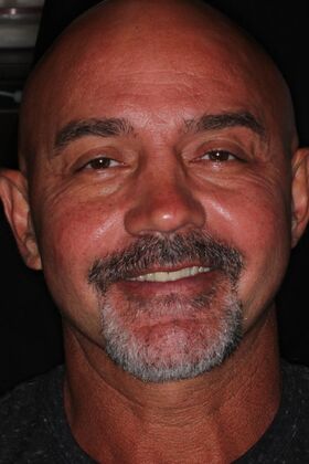 Veneers Case 28 - Before