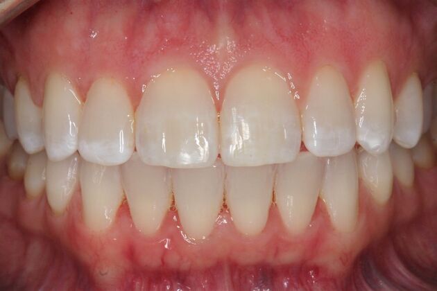 Orthodontics Sarah - After