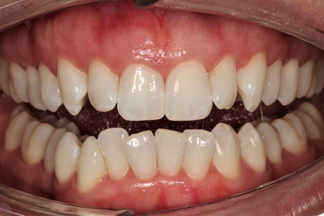 Orthodontics Tracey - Before