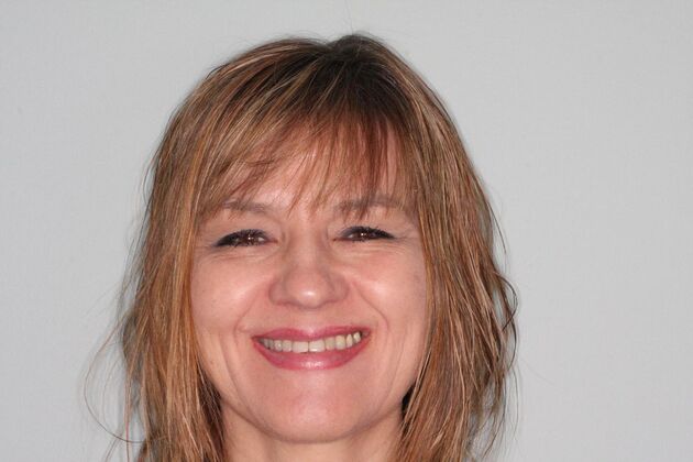 Porcelain Veneers: Case 29 - Before Porcelain veneers