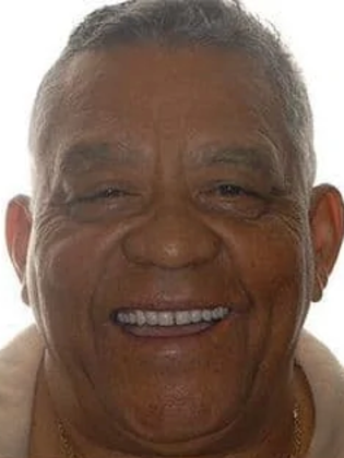 Dental Implants Case 1 - After