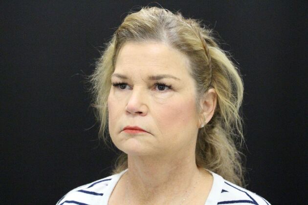 Face & Neck Lifts: Case 5 - Before