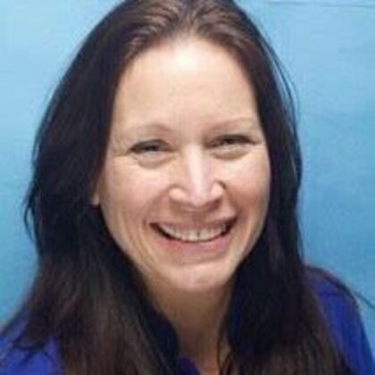 Smile Makeover Laura F - Before