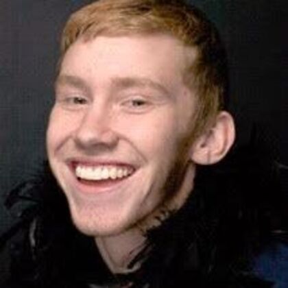 Smile Makeover: Alex - After