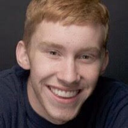 Smile Makeover Alex - After