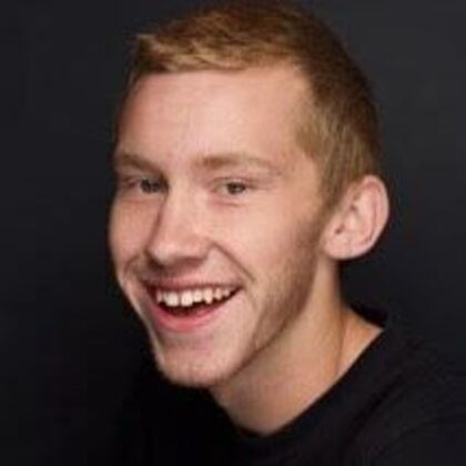 Smile Makeover: Alex - Before