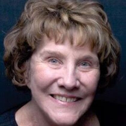 Smile Makeover Margo - Before