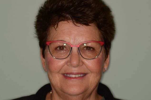 Porcelain Veneers Case 31 - Before