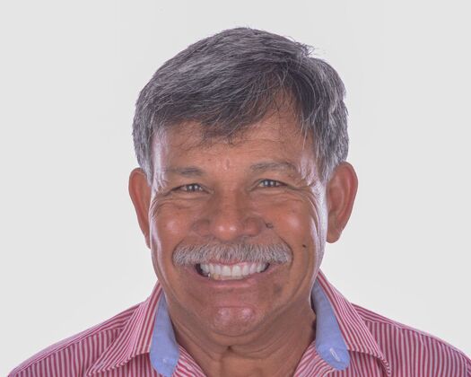 Our Results: UPPER ALL ON 6 TEETH IN A DAY - Day 2 after surgery immediate load healing fixed temps