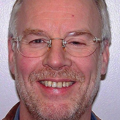 Full Mouth Reconstruction: Raimond K. - Before