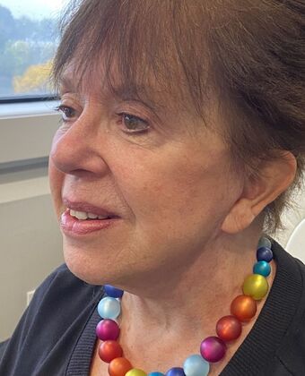 Facelift: Case 30 - Facelift, Norwalk, CT - After