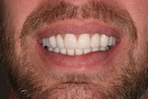 Smile Makeover: Case 47 - After