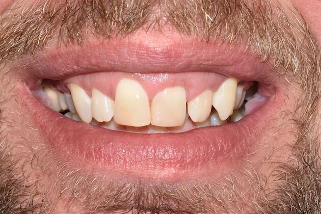 Smile Makeover: Case 47 - Before