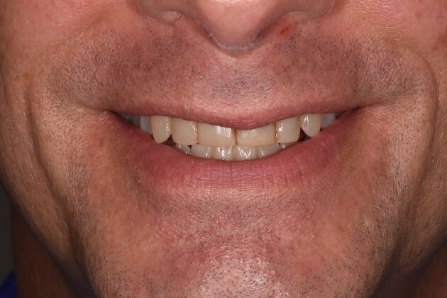 Smile Makeover: Case 48 - Before