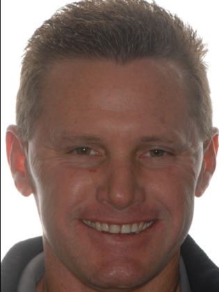 Crowns Case 3 - Before