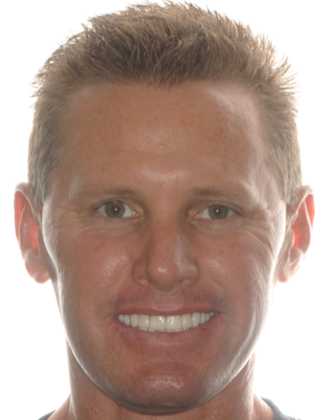 Crowns Case 3 - After