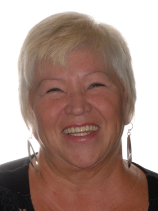 All-on-4 Case 2 - Before