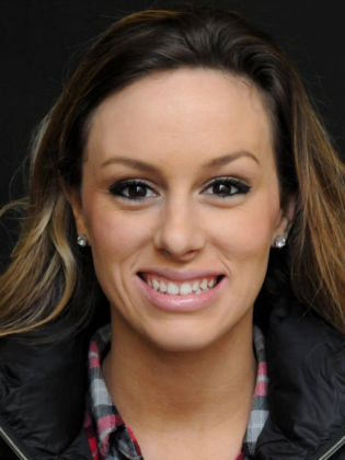 Gum Contouring Case 1 - Before