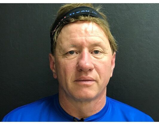 Blepharoplasty Case 8 - Before