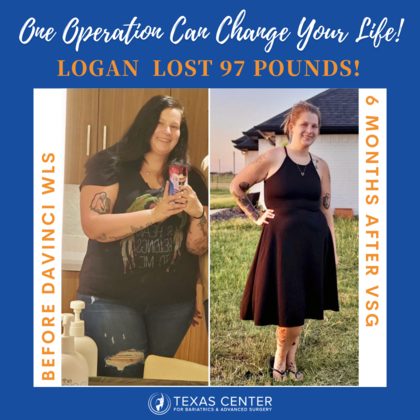 Transformation Tuesday Logan