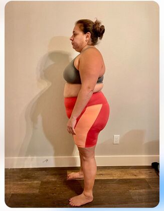 Patient Transformation Stories: Kim