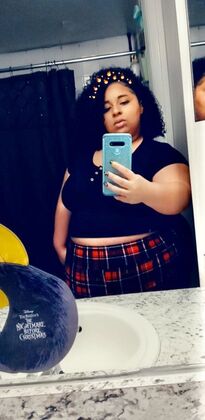 Patient Transformation Stories: Deziree