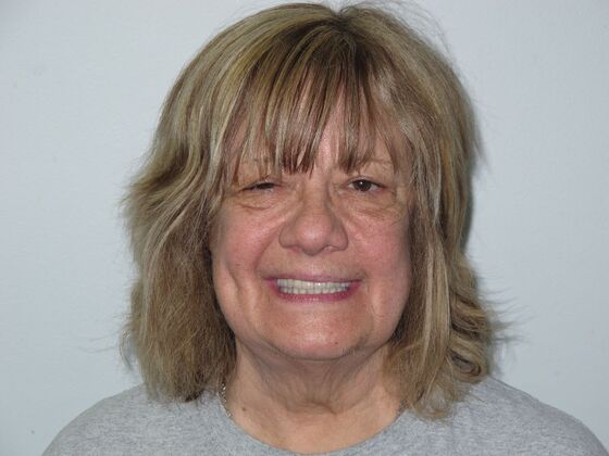 Teeth in a Day: Twenty Years Younger Overnight! - After