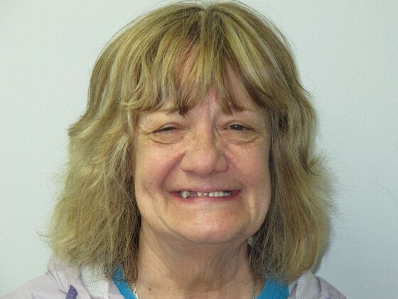 Teeth in a Day: Twenty Years Younger Overnight! - Before