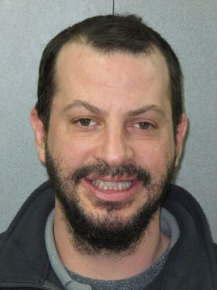 Teeth in a Day: Broken Teeth Solved - Before