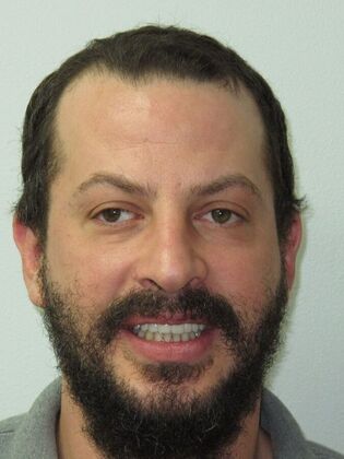 Teeth in a Day: Broken Teeth Solved - After