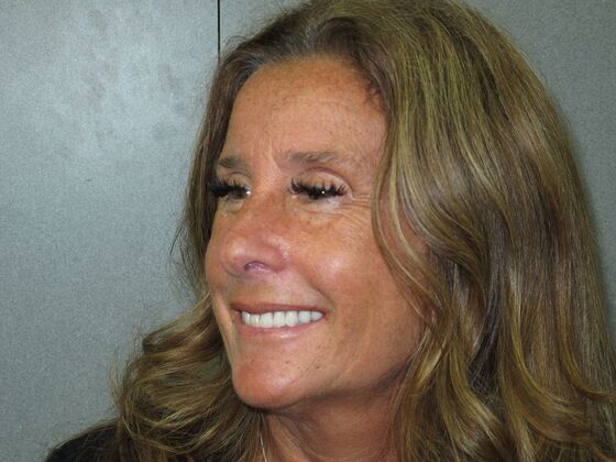 Teeth in a Day: Beautiful Transformation - After