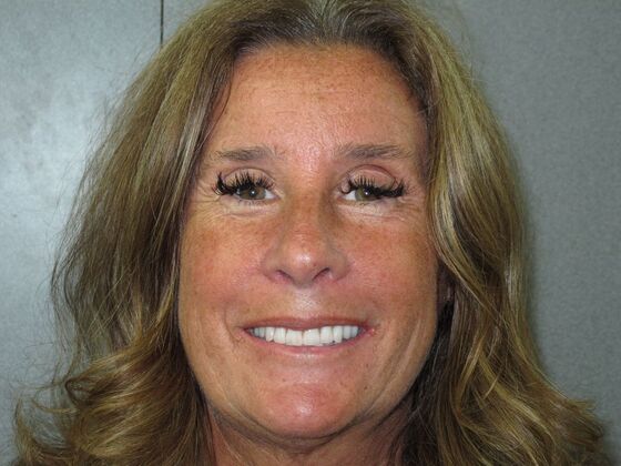 Teeth in a Day: Beautiful Transformation - After