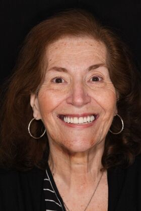 Teeth in a Day: Hard to Believe it was Possible - After