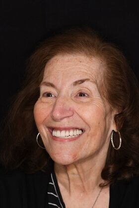 Teeth in a Day: Hard to Believe it was Possible - After