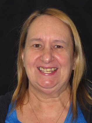 Teeth in a Day: Kathleen can start living again - After