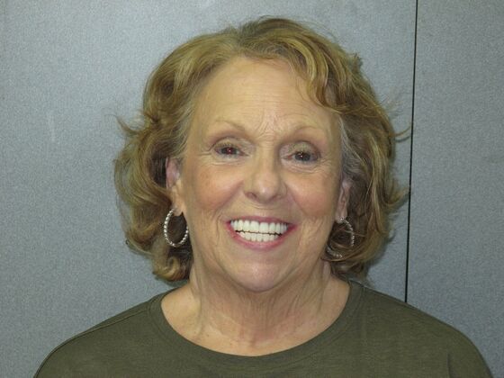 Teeth in a Day: Zest For Life Restored with Smile - Before