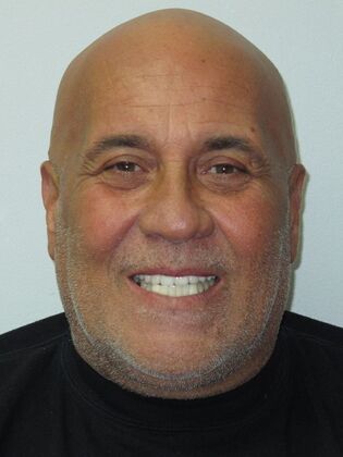 Teeth in a Day: He Joked About His Lone Wolf Tooth, So We Can Too - After