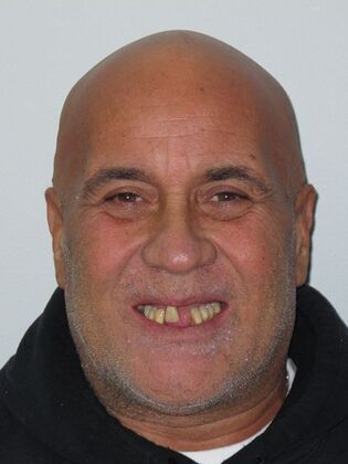 Teeth in a Day: He Joked About His Lone Wolf Tooth, So We Can Too - Before